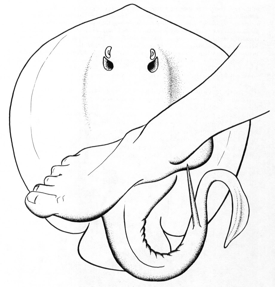 11.jpg a stingray being stepped on