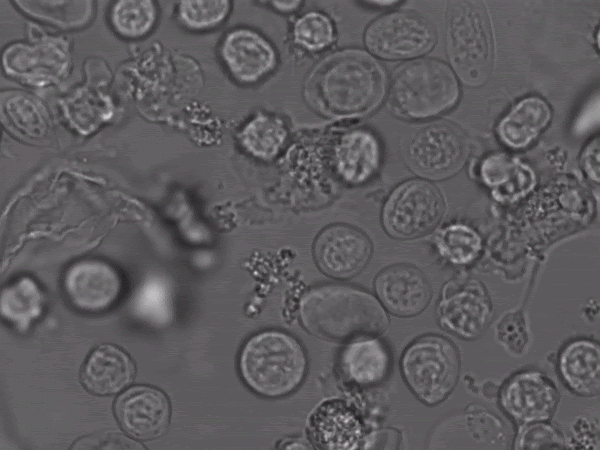 Fig. 56 - round stingray white blood cells