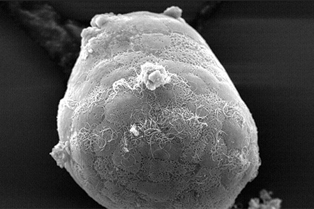 cell examined through electron microscope