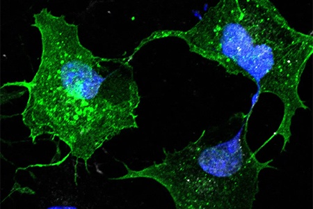 chem_biochemistry.jpg cancer cells