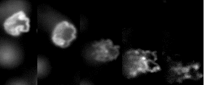 kinetoplasts2.png Kinetoplast at various stages of destruction