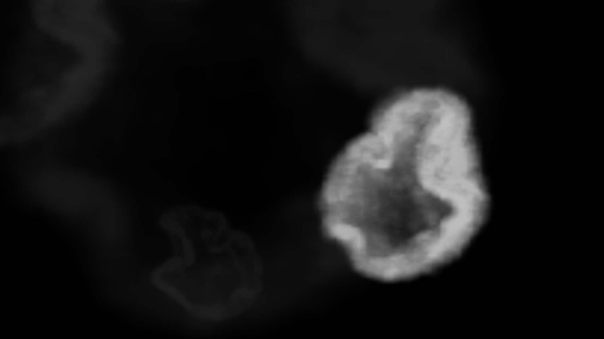 Microscopic video of parasite DNA.