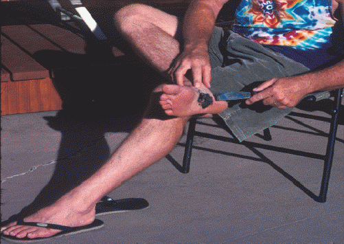 person scraping tar of the bottom of his foot