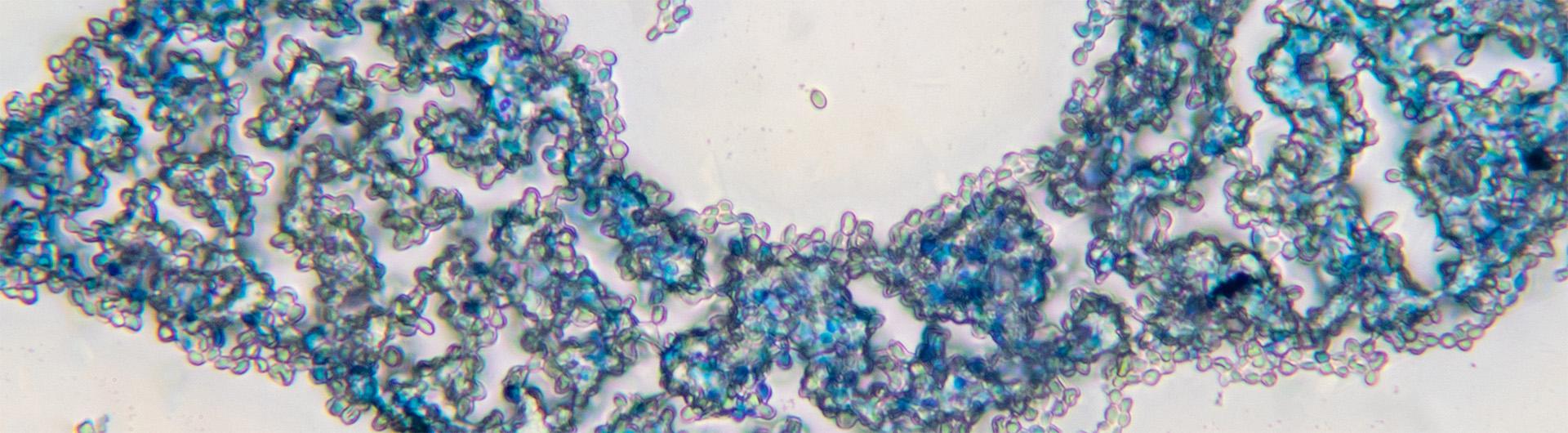 budding yeast under microscope