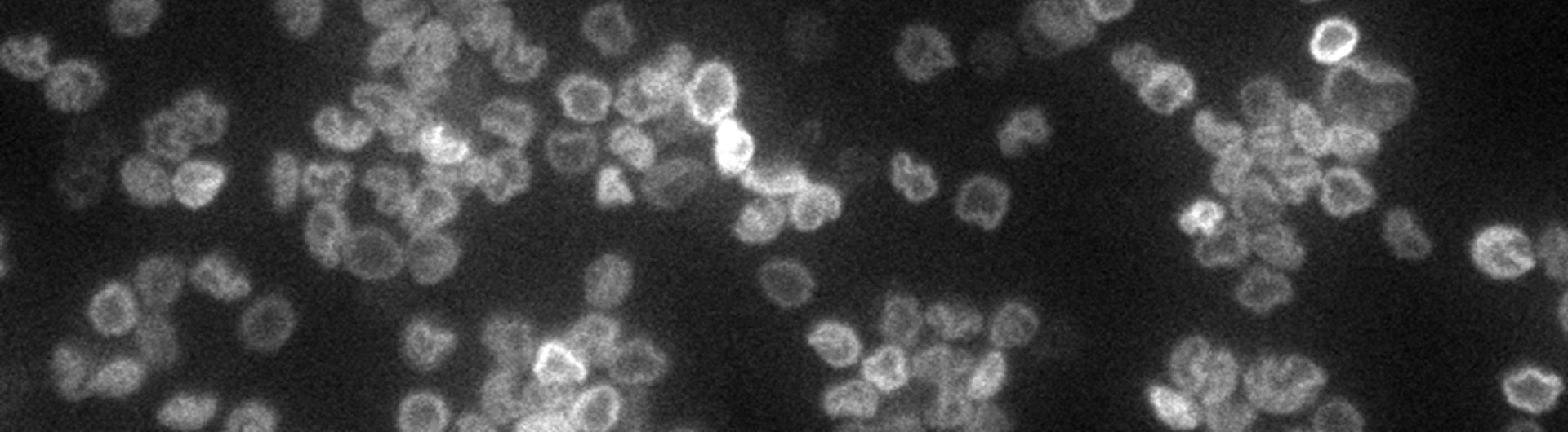 group of kinetoplasts, jellyfish-shaped networks of connected DNA loops