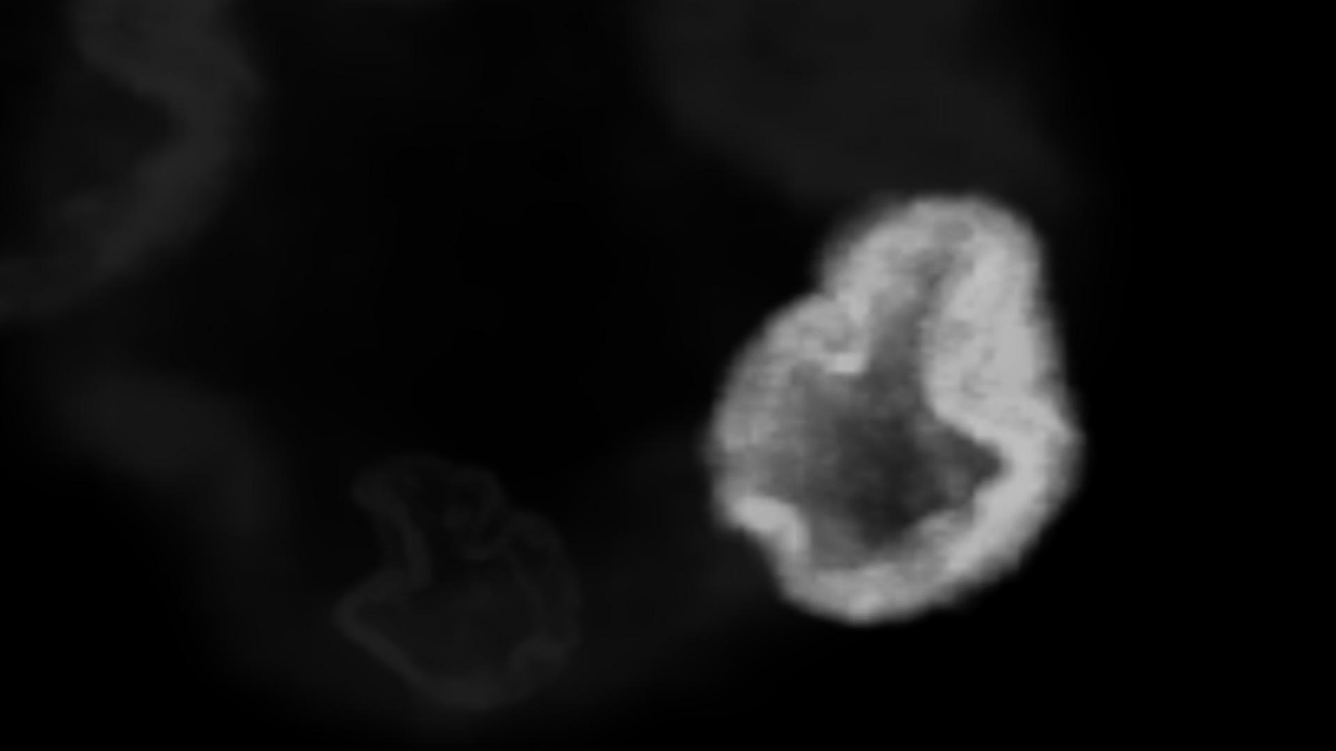 Microscopic video of parasite DNA.