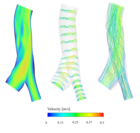 IVC contours